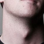 Imagem relacionada a Por que os homens têm pomo-de-adão?