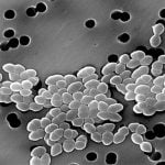 Imagem relacionada a Superbactérias existiram muito antes dos dinossauros