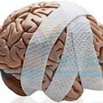 Imagem relacionada a Droga pode restaurar as memórias após uma lesão cerebral