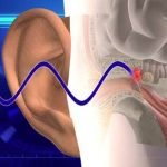 Imagem relacionada a Mistério dos ataques de armas sonoras em Cuba