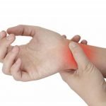 Imagem relacionada a O que é Artrite Reumatoide?