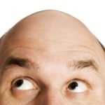 Imagem relacionada a O que causa a Calvície?