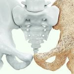 Imagem relacionada a Osteoporose - Sintomas e Tratamentos