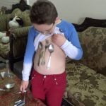 Imagem relacionada a Magneto da vida real pode colar metal em seu corpo