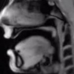 Imagem relacionada a Vídeo de ressonância magnética mostra o que acontece quando você fala