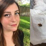 Imagem relacionada a Mulher fica com barata no ouvido por nove dias