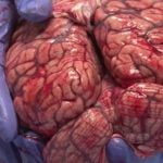 Imagem relacionada a Descoberto região oculta do cérebro humano