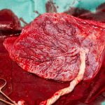 Imagem relacionada a Devo comer minha placenta?