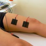 Imagem relacionada a O que é estimulação elétrica muscular?