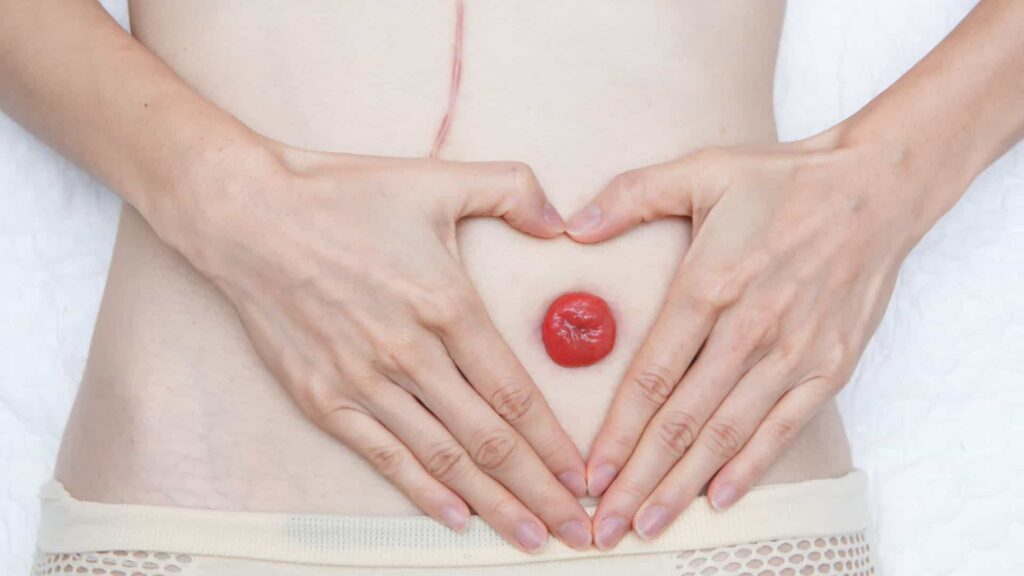 Imagem relacionada a O que é um Estoma?