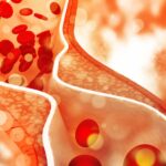 Imagem relacionada a O que é Ataque Isquêmico Transitório? Sintoma sentido por Renato Aragão, o Didi