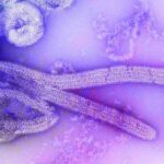 Imagem relacionada a O que é vírus Marburg? Sintomas e tratamentos