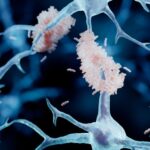 Imagem relacionada a Jovem de 19 anos é diagnosticado com Alzheimer