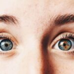 Imagem relacionada a Por que algumas pessoas têm olhos de cores diferentes?