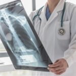 Imagem relacionada a Raios X: a história por trás da descoberta de uma tecnologia que revolucionou a medicina