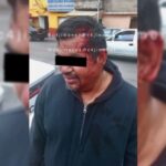 Imagem relacionada a Homem sobrevive milagrosamente a dois tiros na cabeça em cidade do México