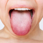 Imagem relacionada a Assim como as impressões digitais, a impressão da língua de cada pessoa é diferente